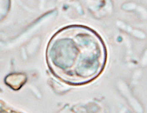 The Cyclospora Outbreak Exposes the Cost of Cutting Foodborne Disease Surveillance