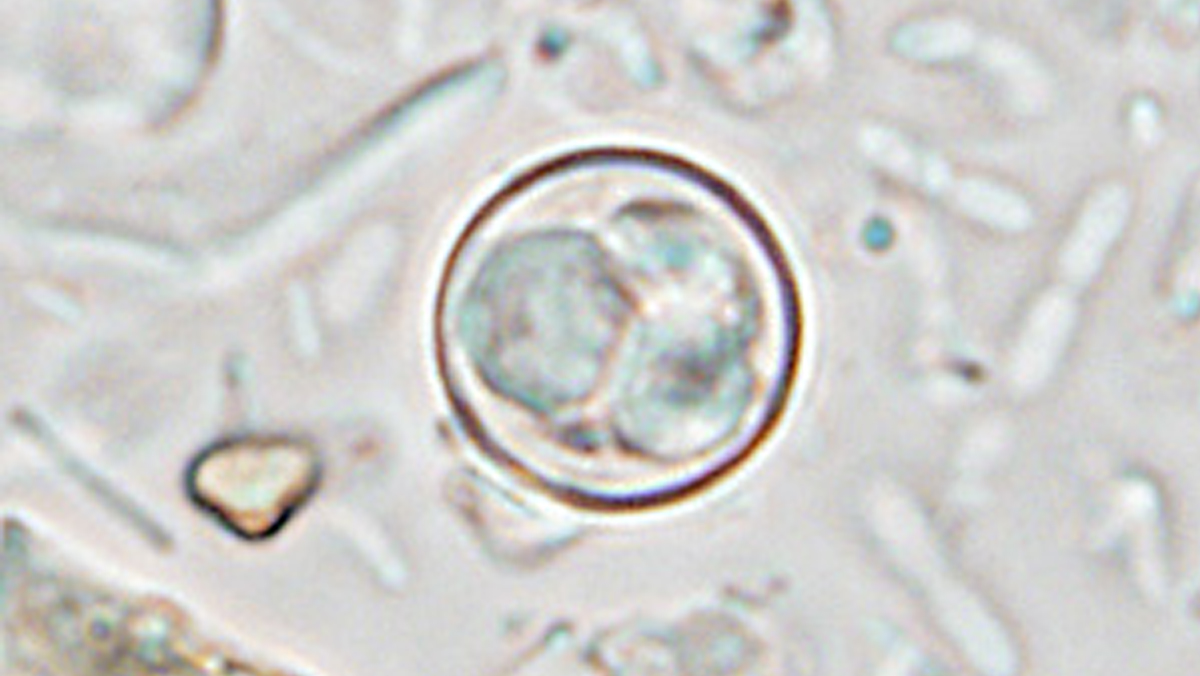 Image of the parasite cyclospora